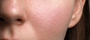 Why Does My Skin Feel Rough When I'm Already Exfoliating?